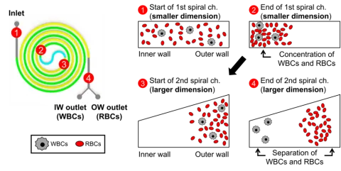 Diagram demonstrating how the MDDS device achieves concentration and separation of red blood cells and white blood cells from a blood sample.