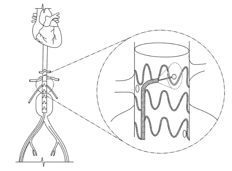 Fenestrated aortic endograft located near the visceral arteries