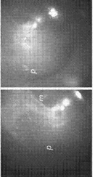  Illustrates four visible images of the middle ear cavity of a patient's ear taken using visible light illumination and detection.