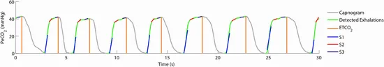Fig. 1: The capnogram collected from a cardioversion patient is shown with detected exhalation segments highlighted. Also marked are four features extracted from the capnogram exhalation segments. These features are etco2 and slope features S 1, s2, and s3.