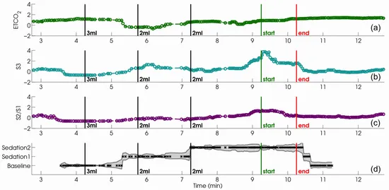 Fig. 2: Causal clustering of the capnogram recording from a 75-year-old woman undergoing cardioversion. The three features used in clustering are plotted in the first three panes. Black vertical markers correspond to propofol administrations, the green marker aligns with the start of the cardioversion procedure, and the red marker indicates the end of the procedure. State assignments following causal k-means clustering are shown in the fourth pane.