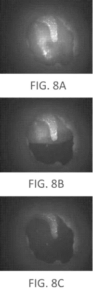 llustrates a short wave infrared image of a middle ear model with no fluid taken using the short wave infrared otoscope device