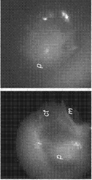  Illustrates four SWIR images of the middle ear cavity of a patient's ear taken using the short wave infrared otoscope device