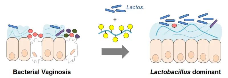 A depiction of a combination treatment for persistent bacterial vaginosis (left) with a silk-based mucin-inspired glycopolymer and Lactobacillus probiotic.