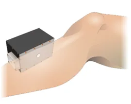 Image 1. Illustration of portable magnetic resonance sensor placed on lower leg of human patient.
